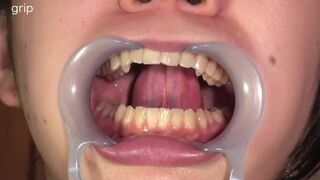 Dental Exam