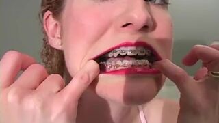 Mouth Bizarre Braces Red Lipstick with Slutty Talk